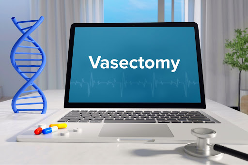 Vasectomy Questions