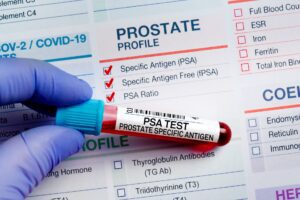 prostate cancer risk factors