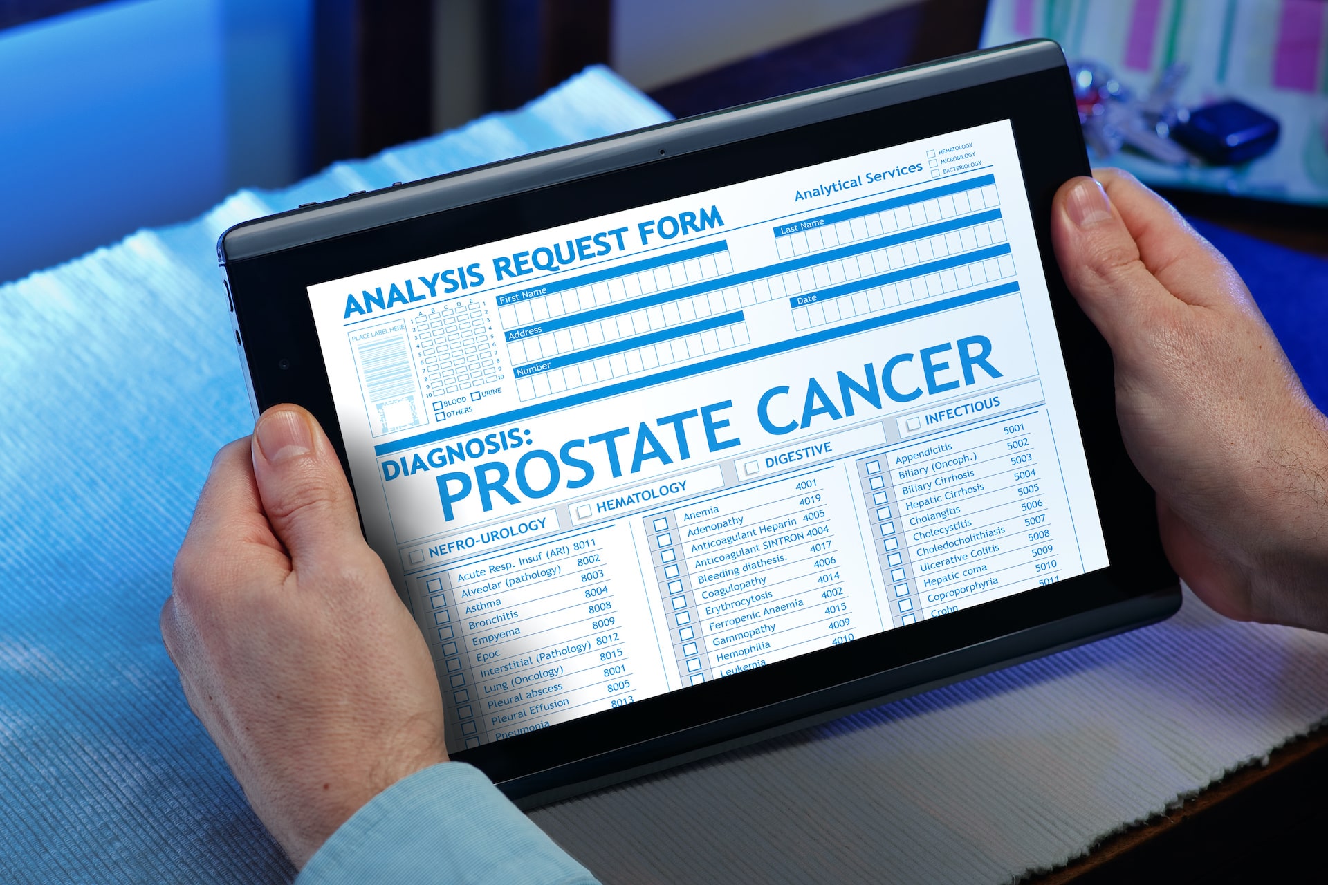 prostate cancer second opinion