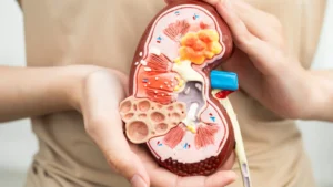 A person holding an anatomical figure of a kidney cross-section.